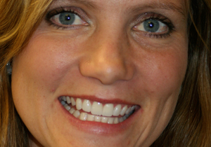 gallery1-thumb.jpg