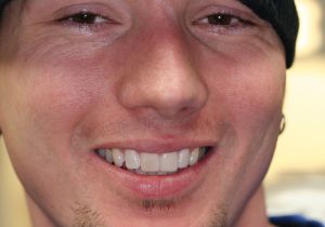 Trial-Smile-8.jpg