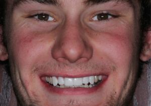 Trial-Smile-9.jpg